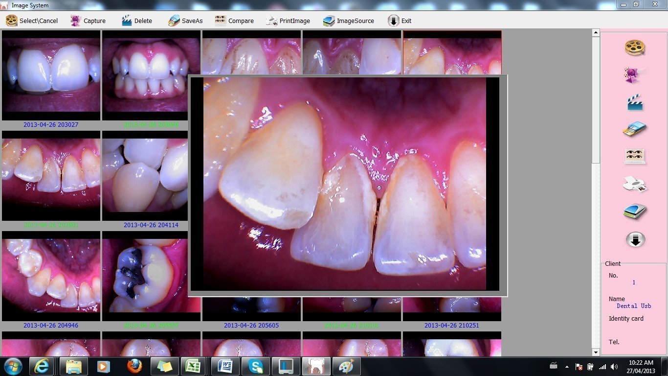 Intraoral Camera, ProDENT PD740 ,WORK With dexis,FREE US SHIPPING