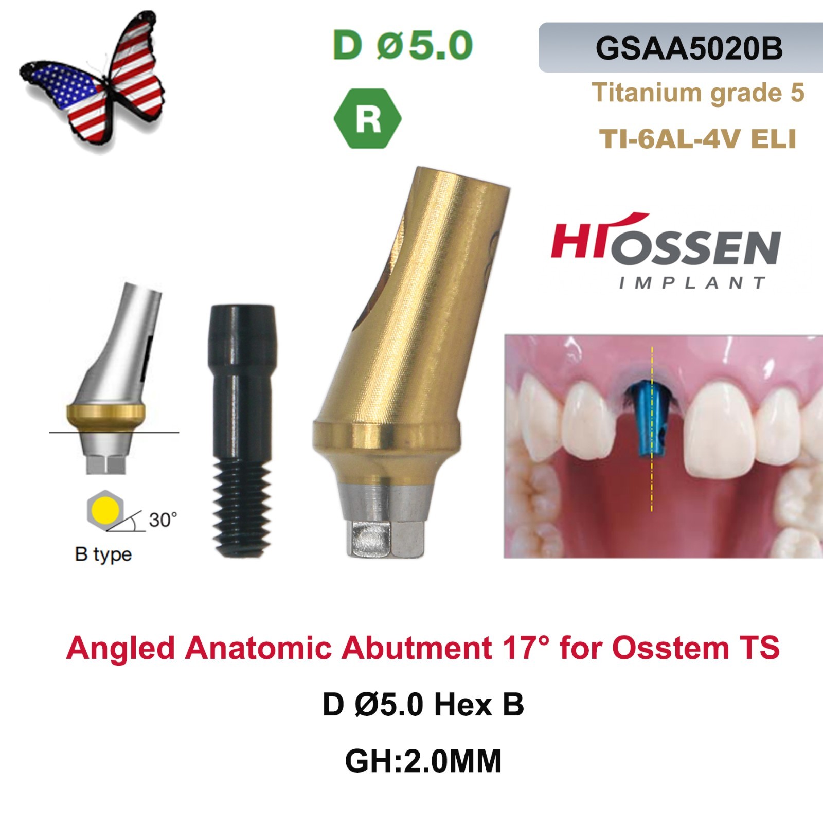US 17° Angulated Abutment Regular Hex A/B Type For Osstem TS Regular Platform Ti