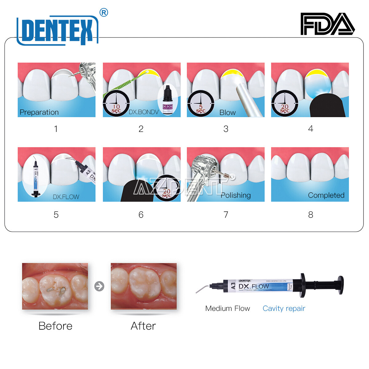 DENTEX Dental Universal/Flowable Light Cure Composite Resin A1 A2 A3 Shade USA