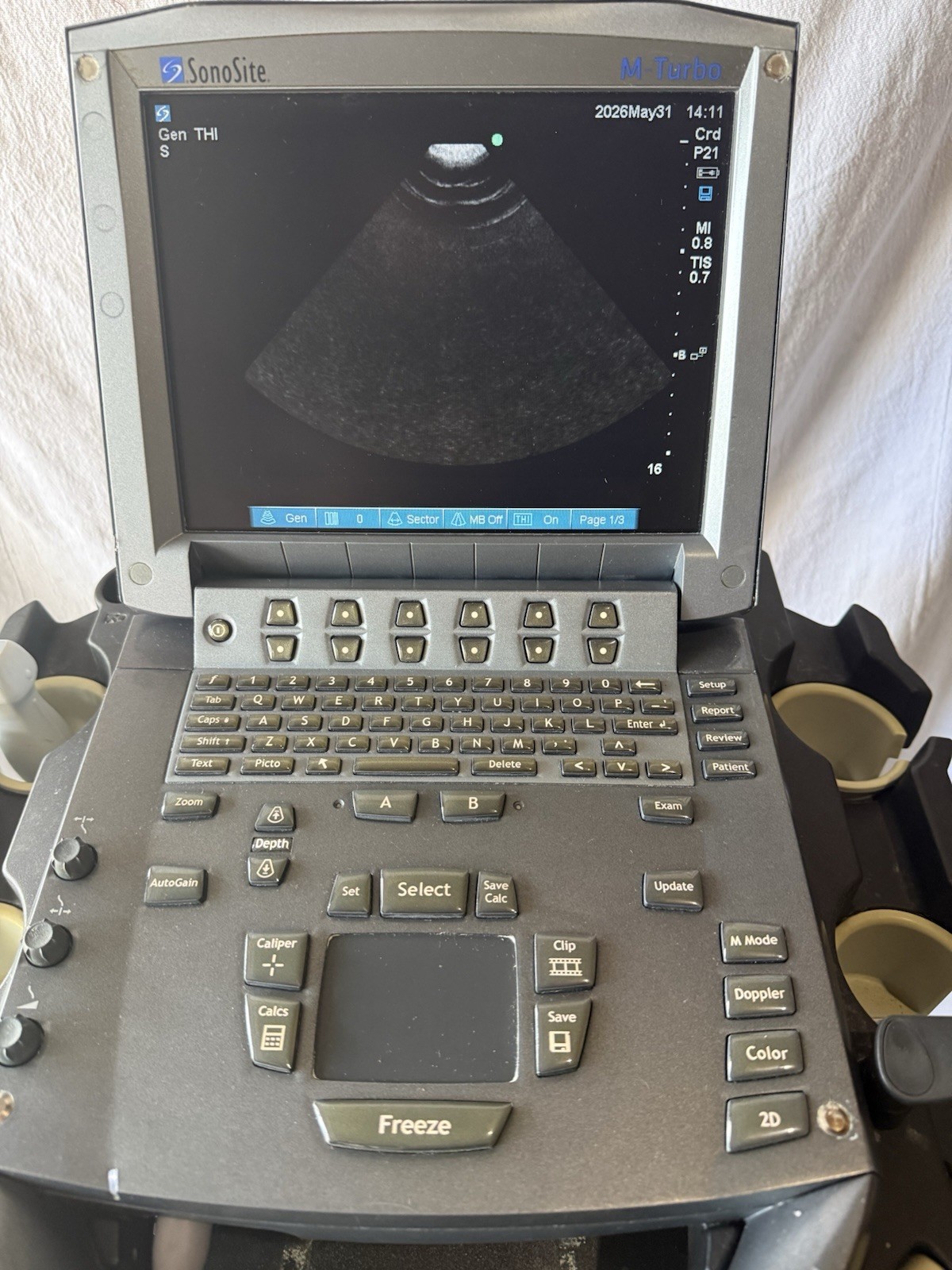 SonoSite M-Turbo Ultrasound With Cart & P21x Transducer Probe