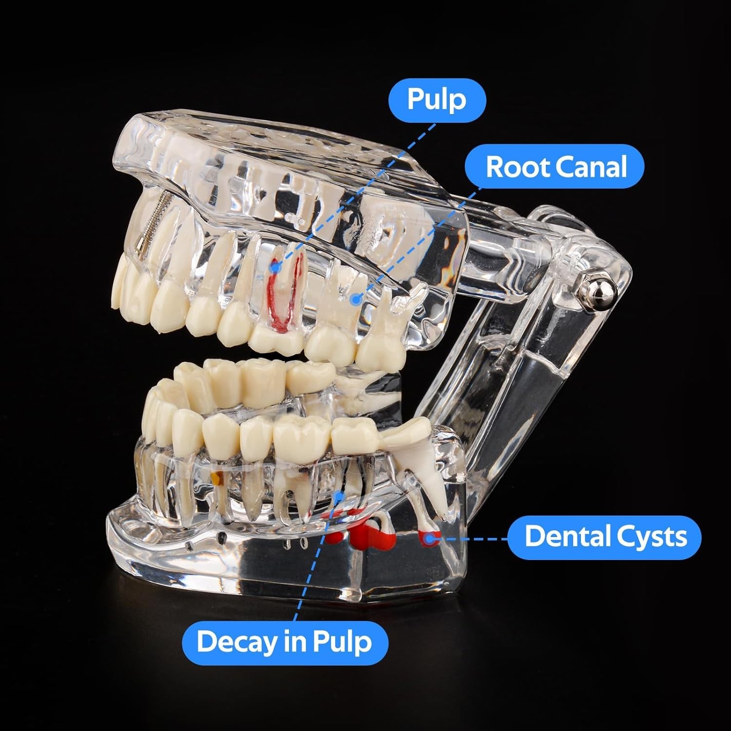 Dental Teaching Tool with Removable Teeth