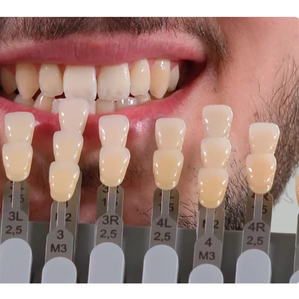 THE ORIGINAL VITA 3D MASTER AUTHENTIC TOOTH SHADEGUIDE with Dental BLEACH SHADES