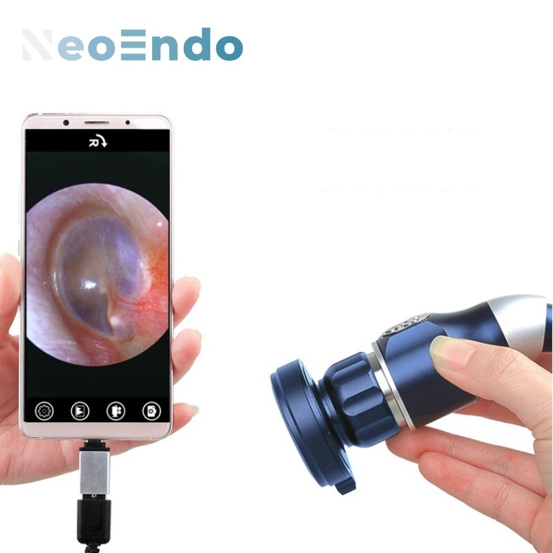 Portable Full HD 1080P Medical Endoscope Camera for ENT Surgery & Inspection