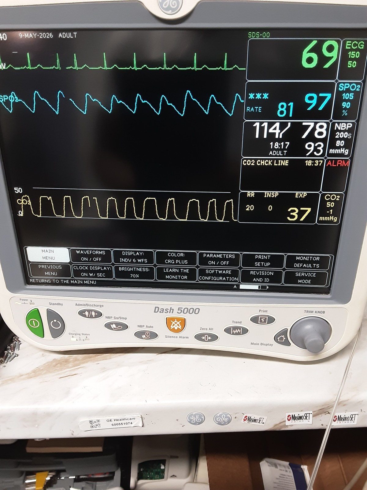 GE Dash 5000 massimo sp02 and soft 7.3 with 4 IBP and Co2 , 90 DAYS FREE RETURN