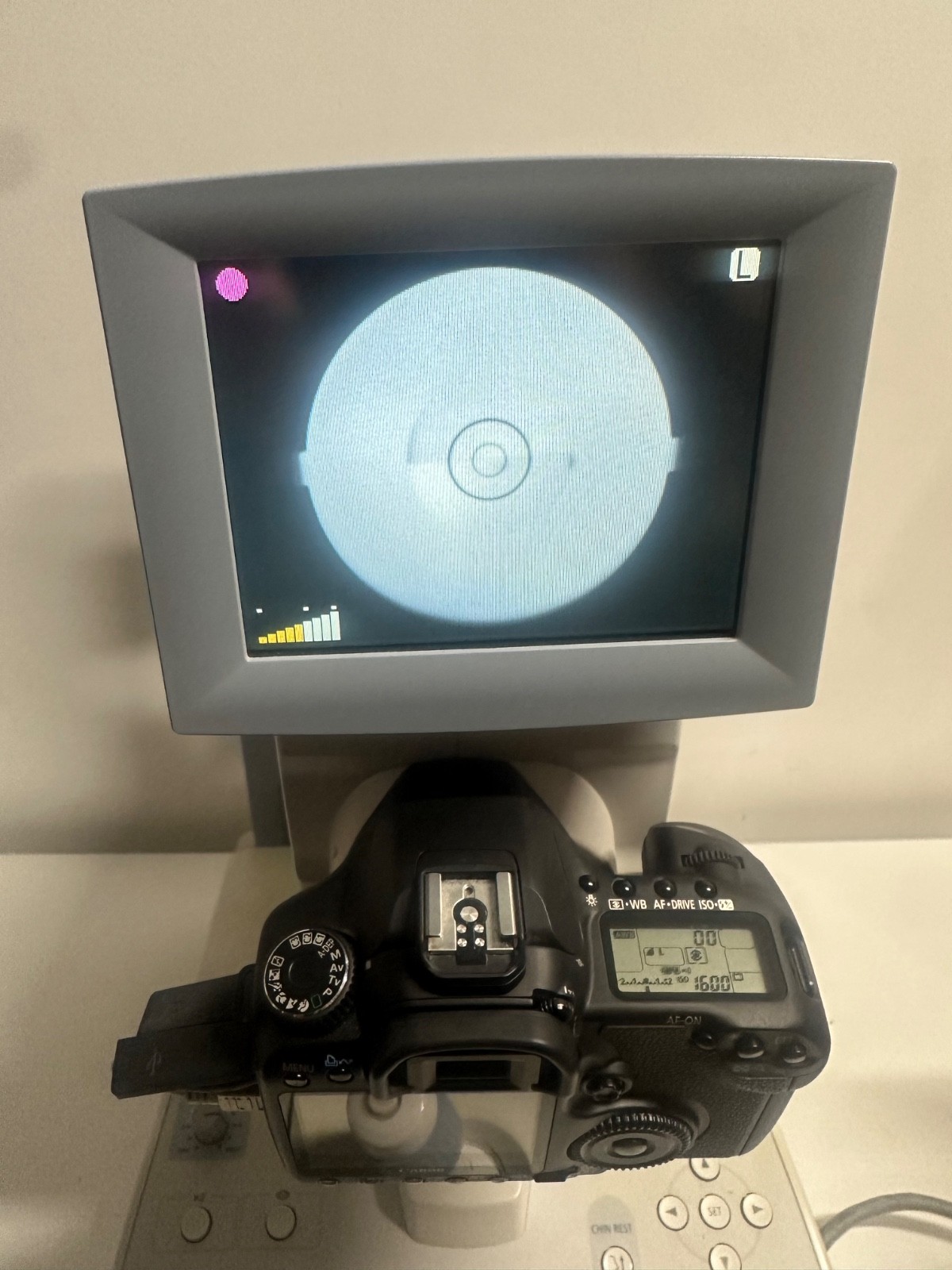 Canon CR-1 Digital Retinal Camera