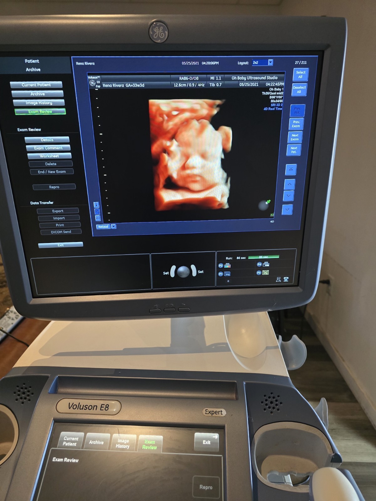 GE Healthcare Voluson E8 Expert Cart Ultrasound w/ Monitor Touchscreen 2D/3D