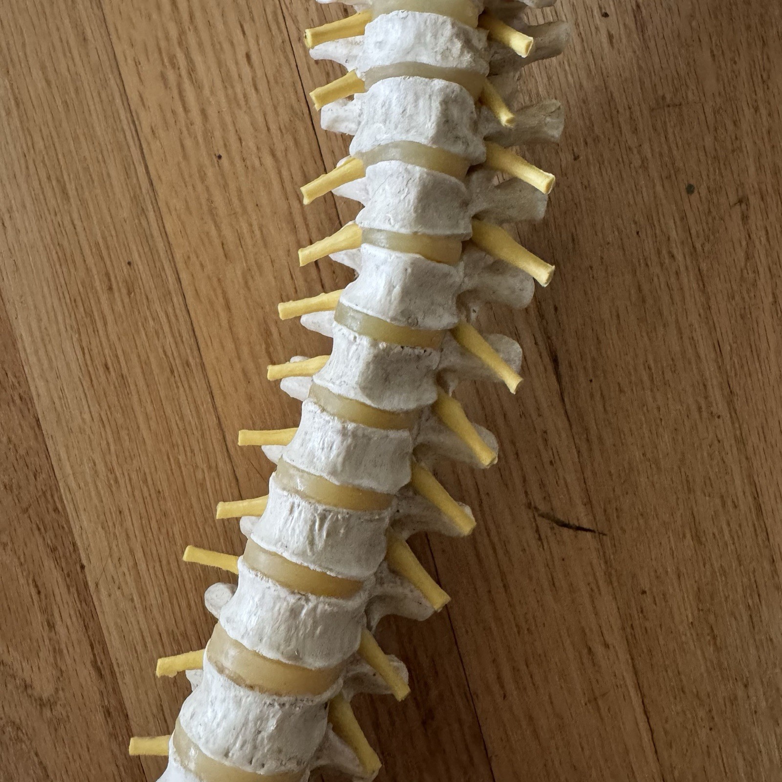 MEDICAL MODEL SPINE BACKBONE WITH PELVIS HIPS ADULT SIZE GERMANY SCIENTIFIC