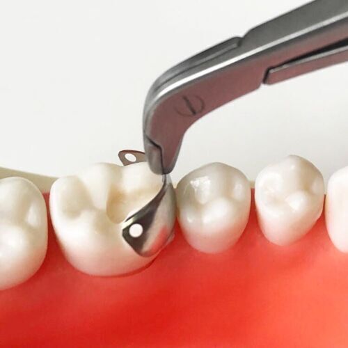 Dental Matrix Bands Sectional Matrice Titanium Clamp Fit Garrison Palodent V3