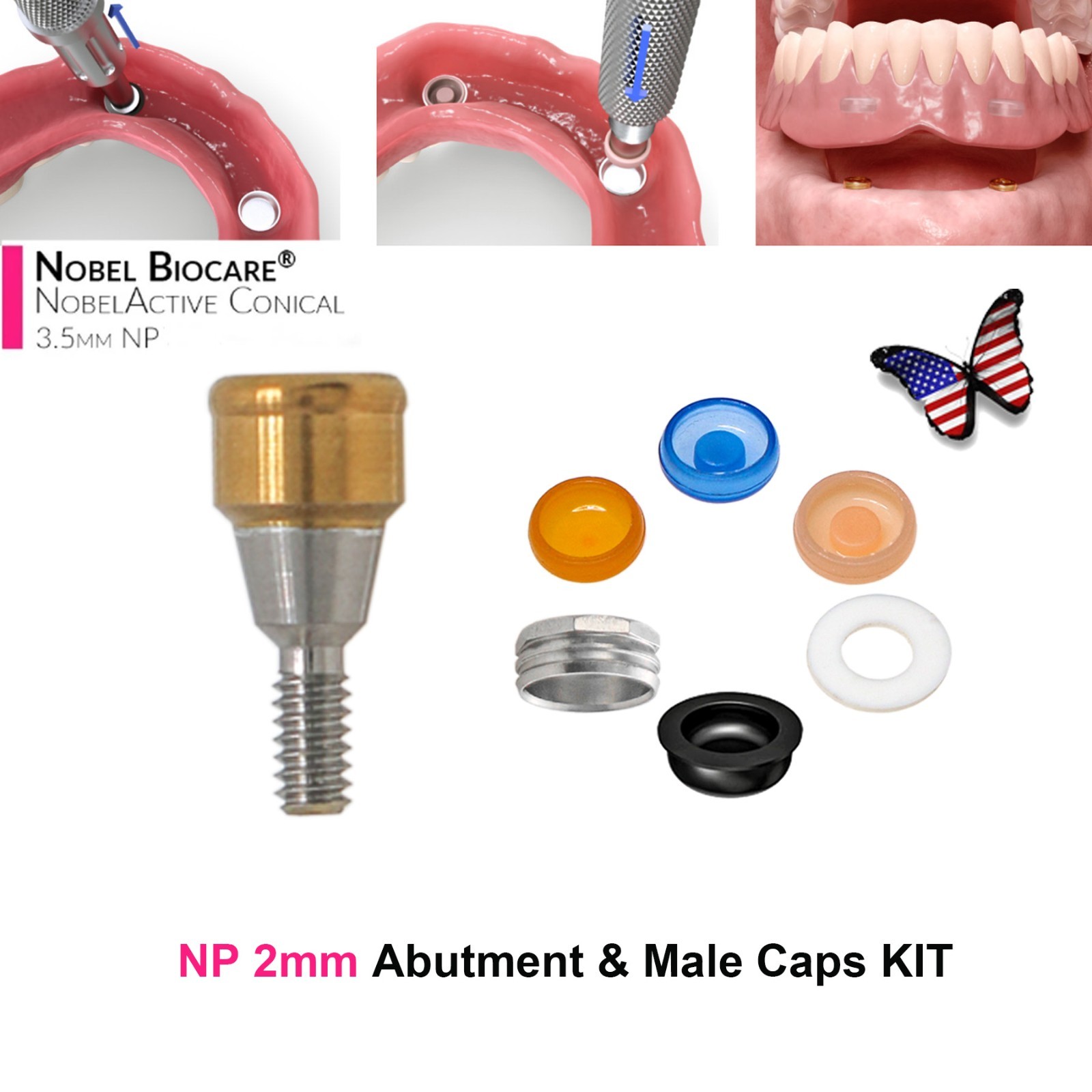US Locator Accessory For Nobel Dental Core Implant Tool Abutment Cap Replacement