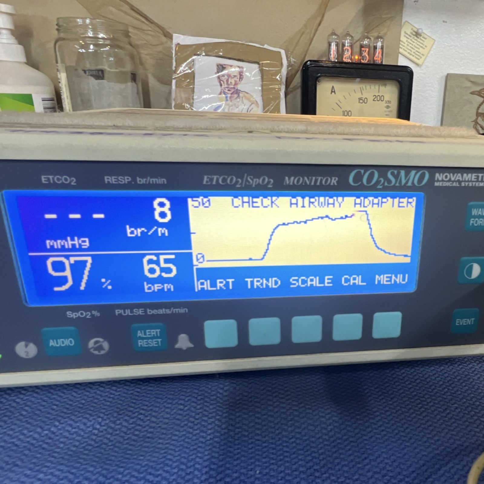 Novametrix CO2SMO 7100 ETCO2 SpO2 Respiration Monitor Battery Operated Printer