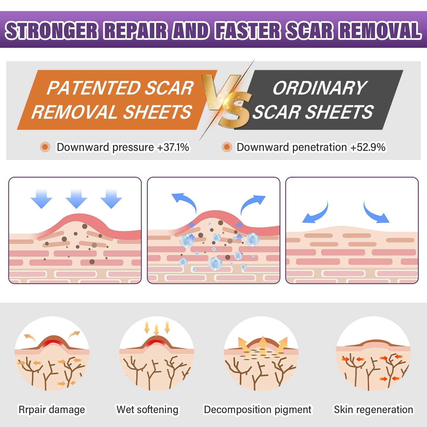 Silicone Scar Sheets, Medical Grade Tape for 1.5M, Beige