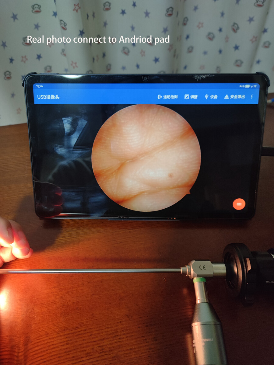 Portable Medical Endoscope HD 1080P USB Camera With 60FPS Frame Rate