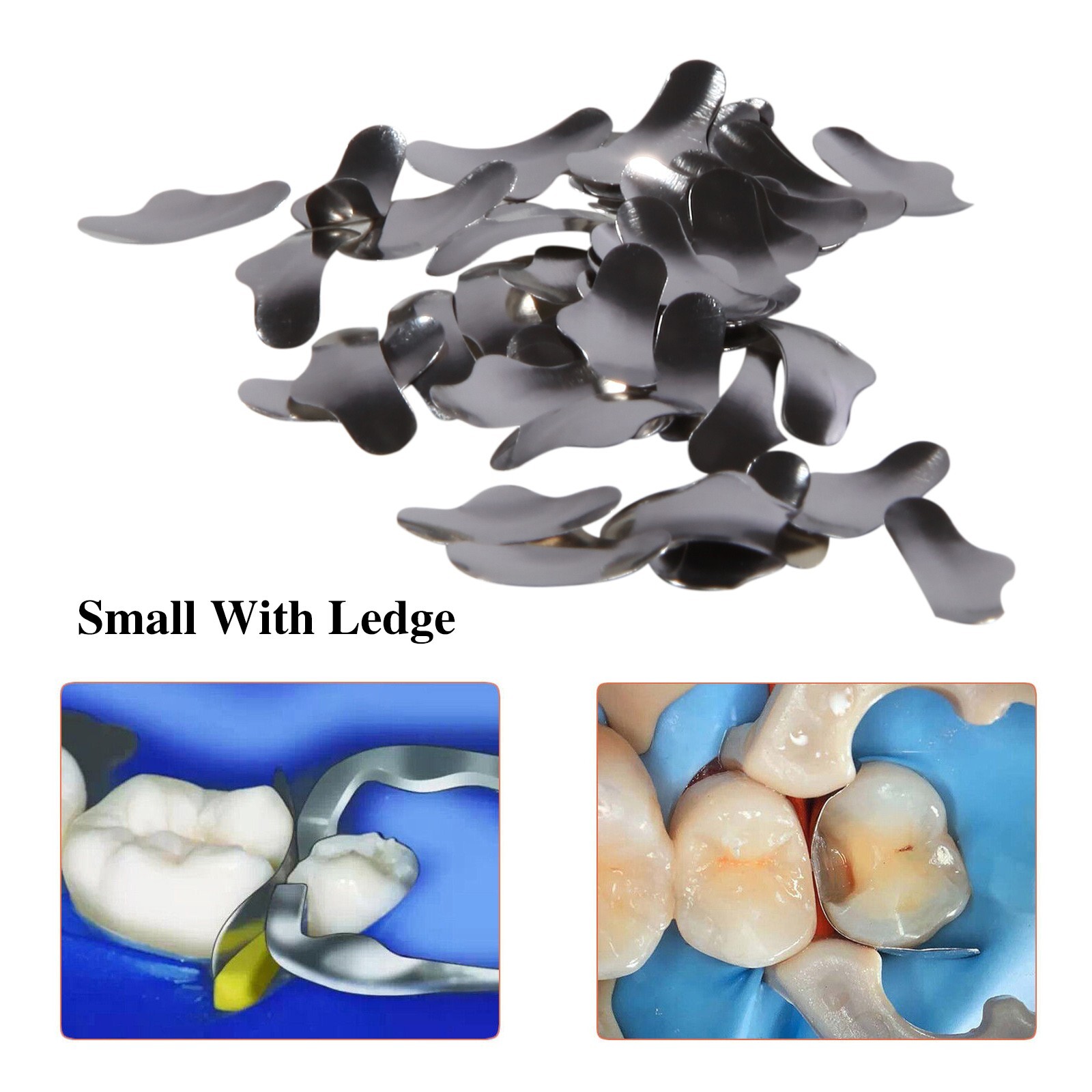 50 Pcs Dental Sectional Contoured Metal Matrices Refill Matrix Band Ledge Small