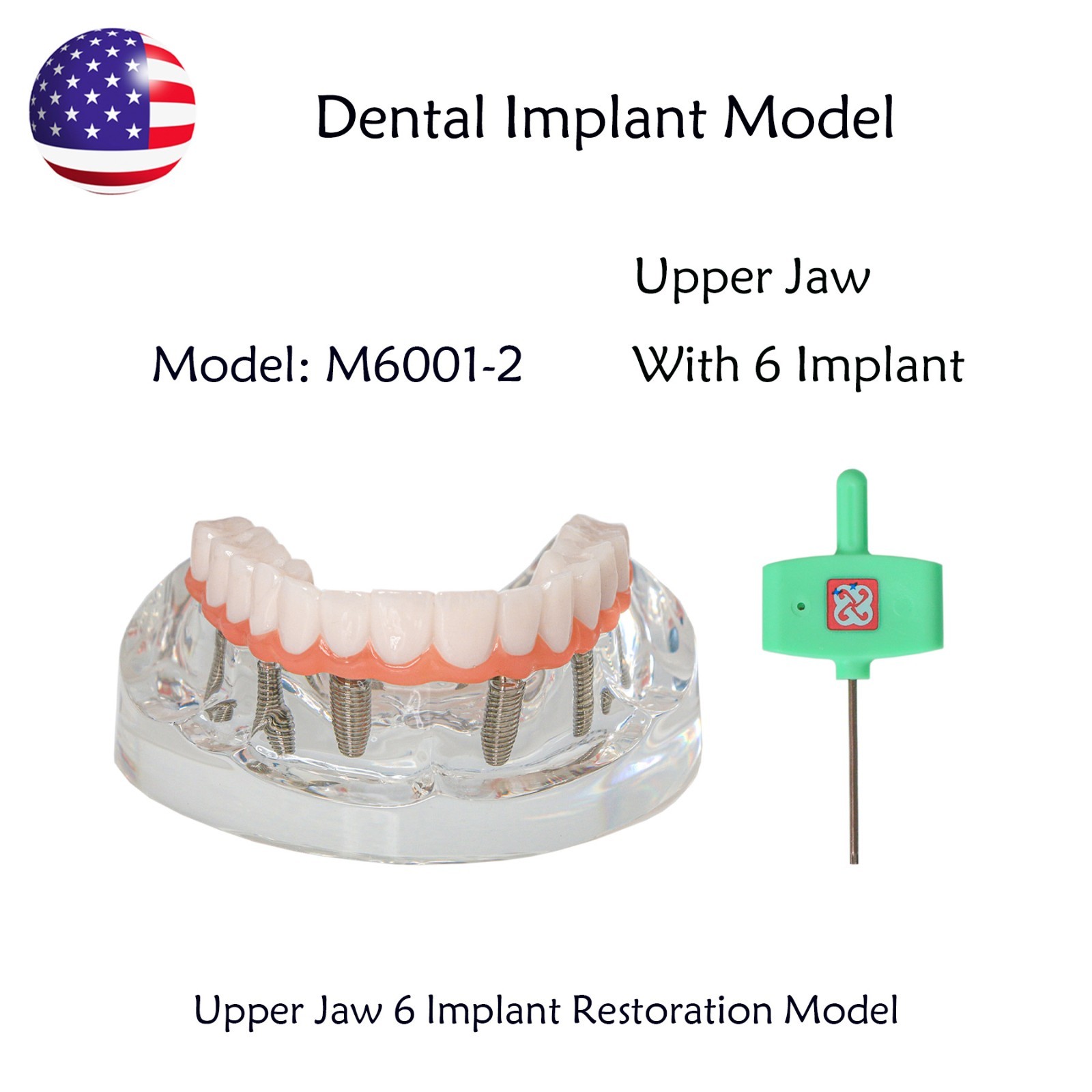 US Dental Implant Overdenture Model All-on-4/6 Upper Jaw Restoration 4/6 Screws