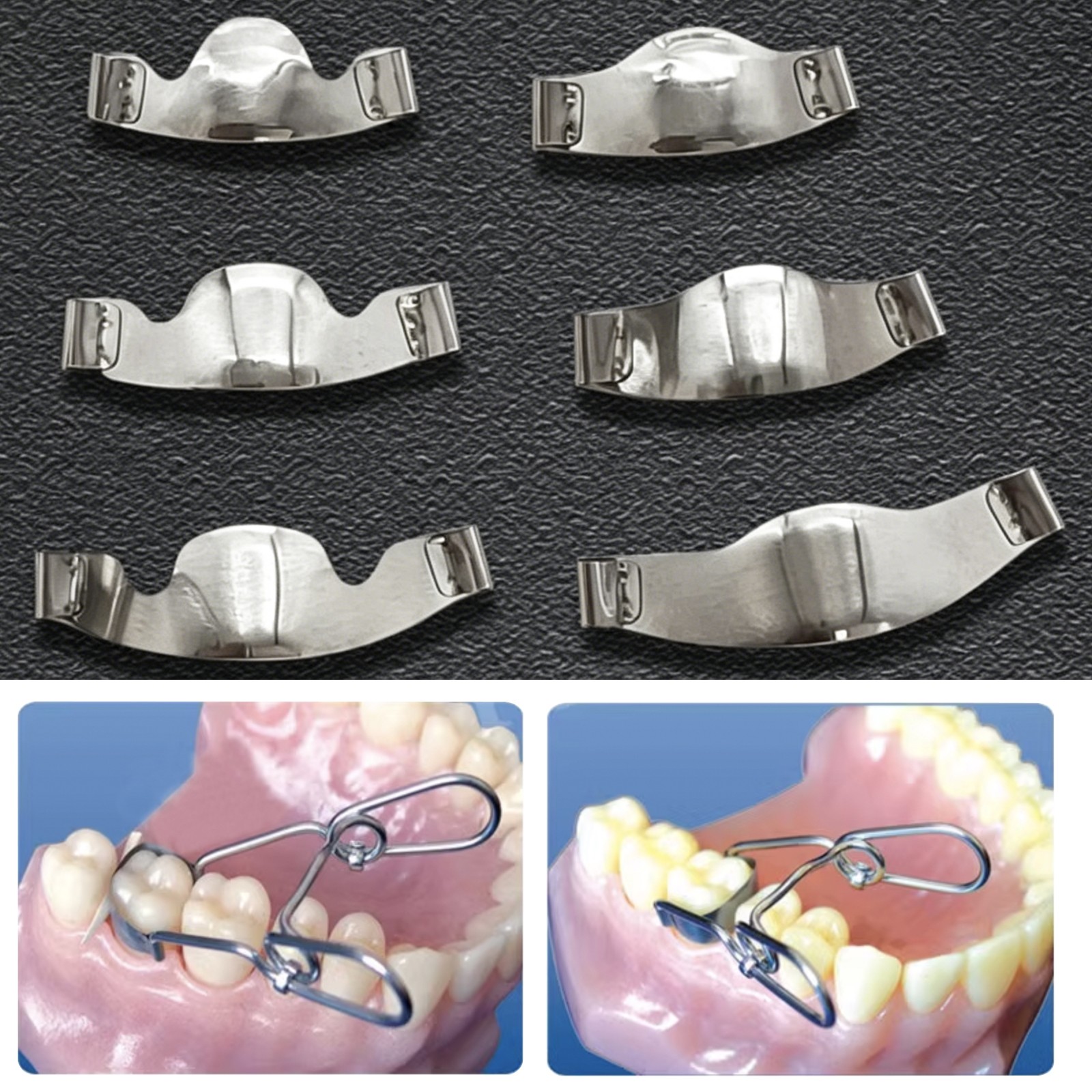 Dental saddle-shaped Matrix Band Fit Garrison Palodent V3 System