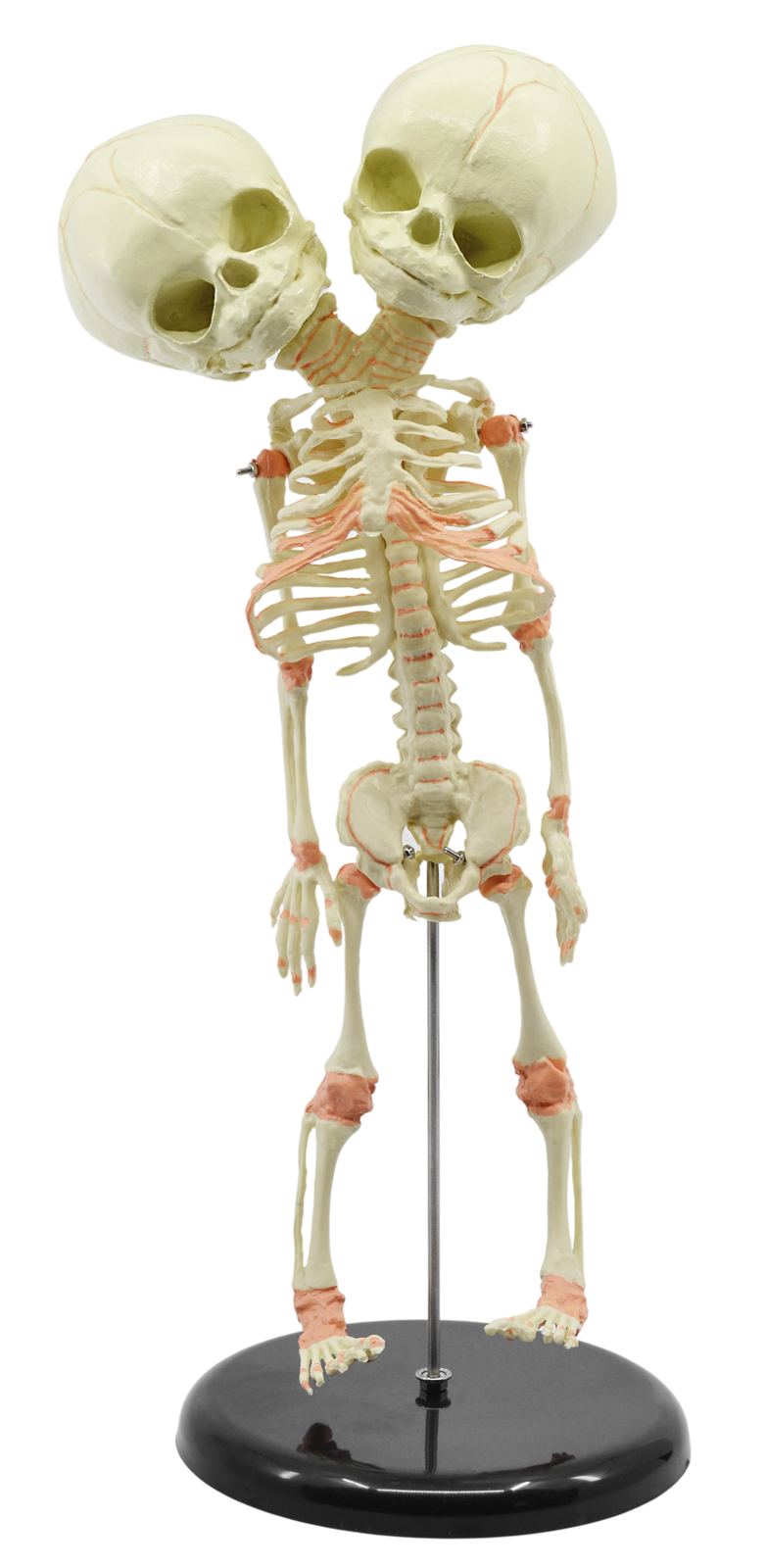 Infant Fetus Skeleton Model, Mini Size – Twin, Conjoined Skull – Eisco Labs