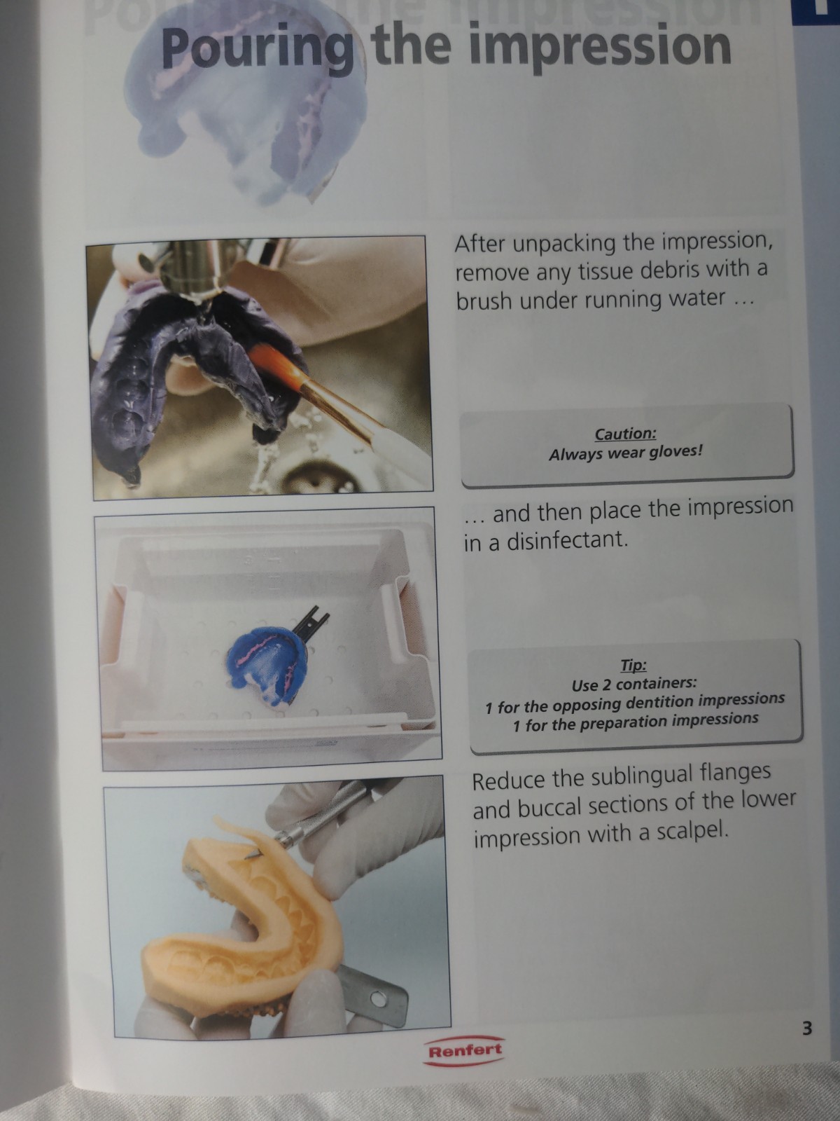 Renfert – Master Models Functional Model Fabrication Manual