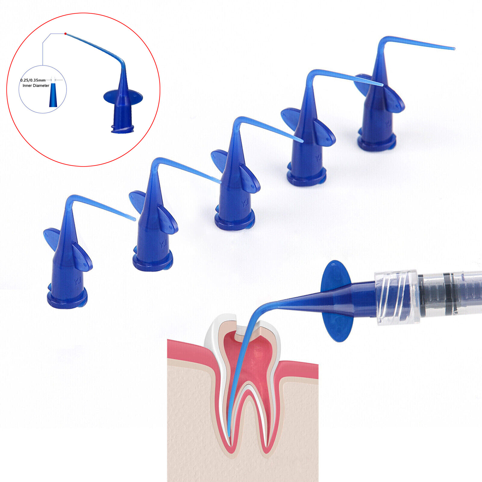 0.25/0.35mm Dental Endo Irrigation Needle syringe Tips Disposable Irrigator Tip