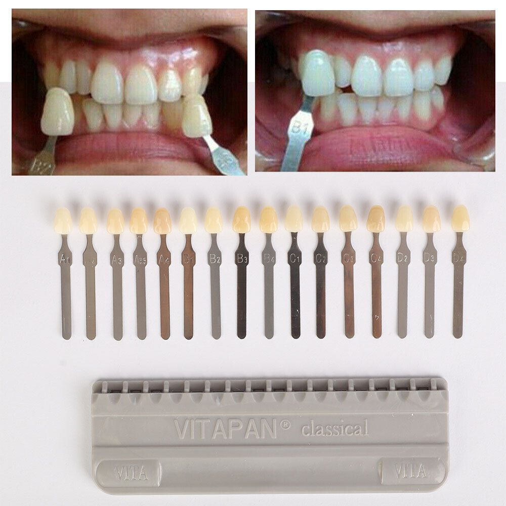 16 Colors Shade Guide Teeth Dental Materials For VITA A1-D4 Whitening Comparison