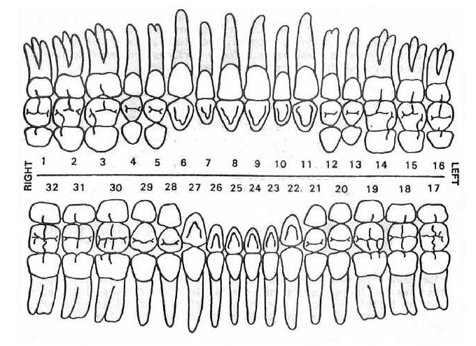 #6 Upper Right Cuspid tooth – Dental Polycarbonate Temporary Crowns 7 sizes