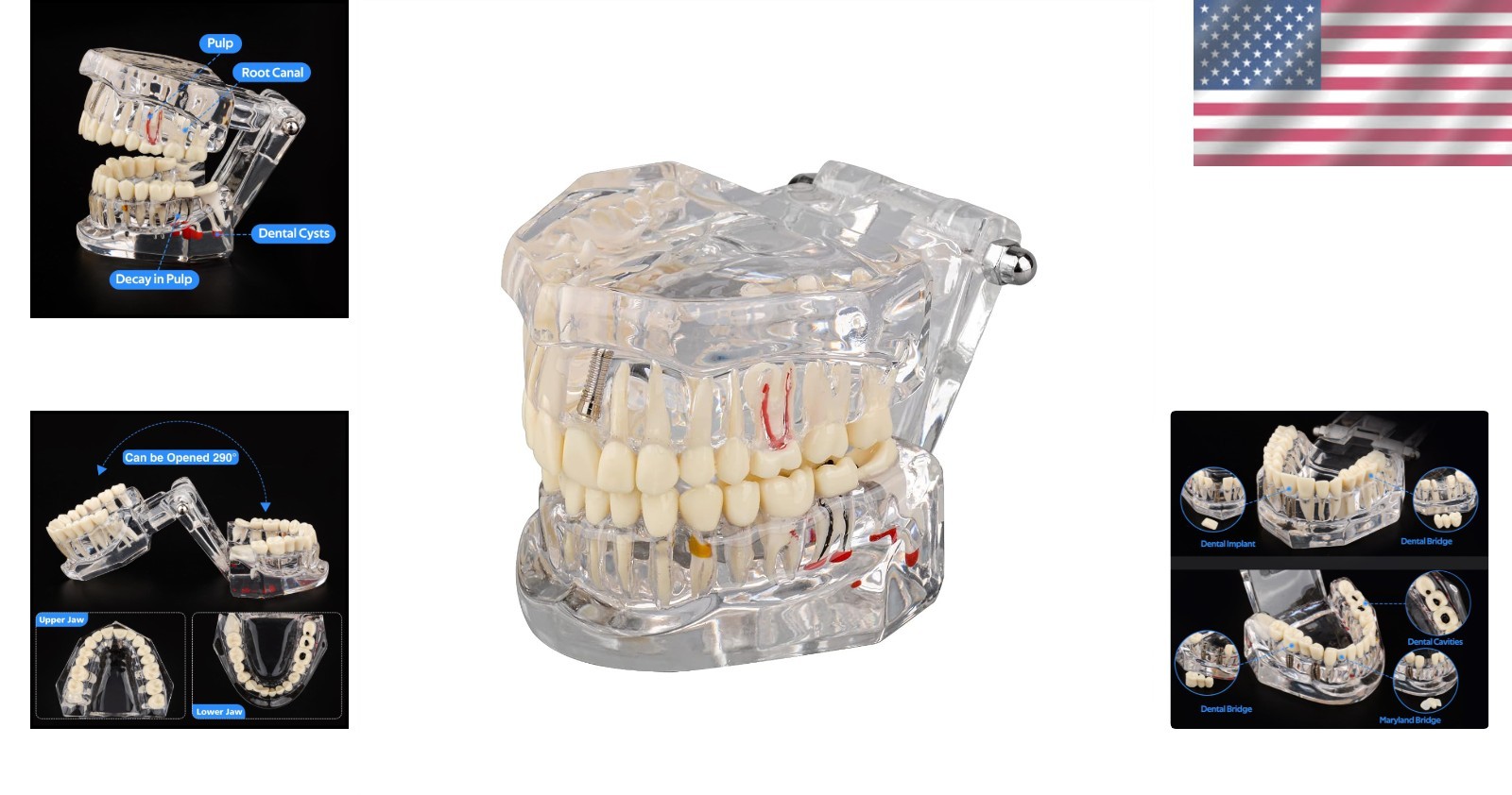 Dental Teaching Tool with Removable Teeth