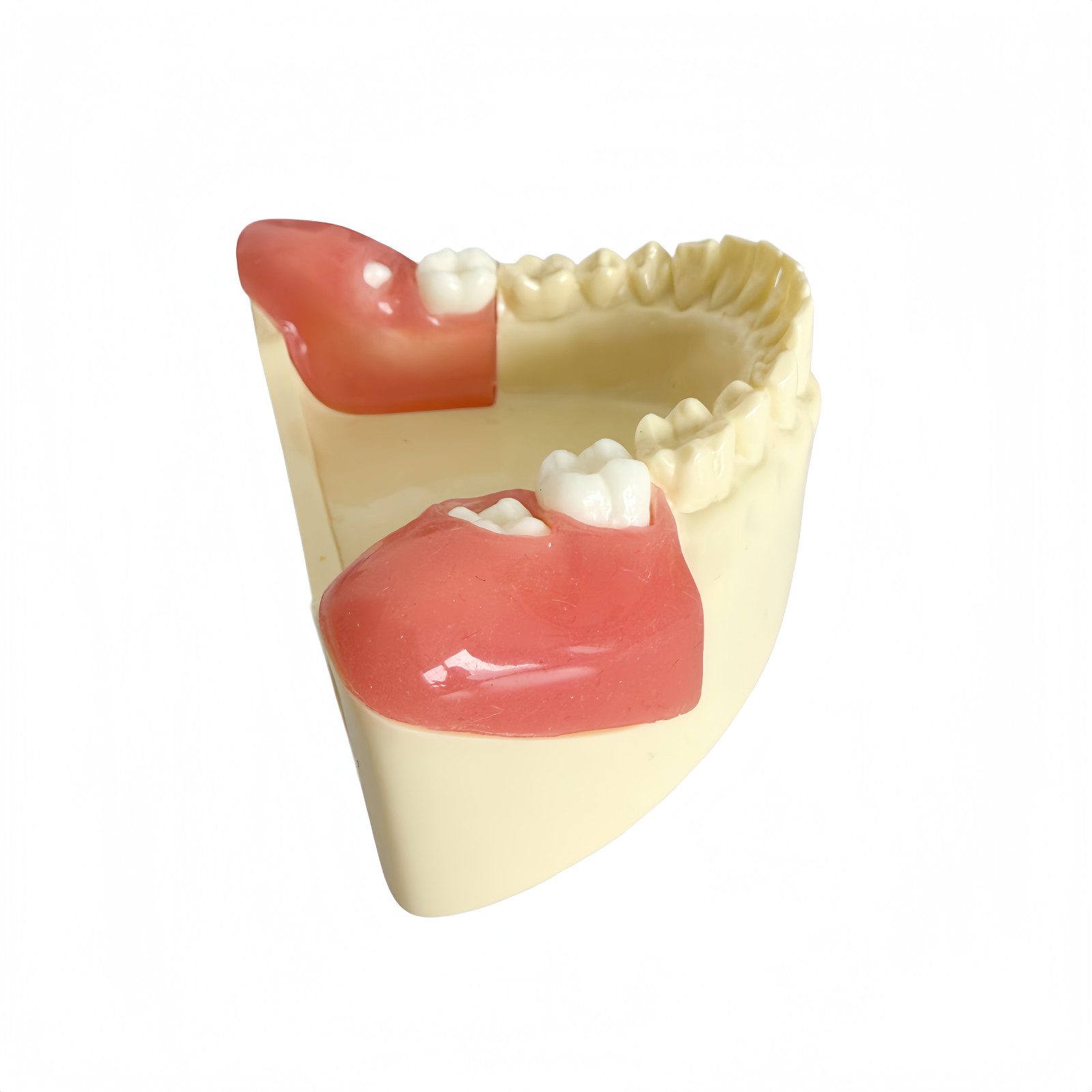 Dental Training Model for Impacted Wisdom Tooth Extraction Practice Surgery