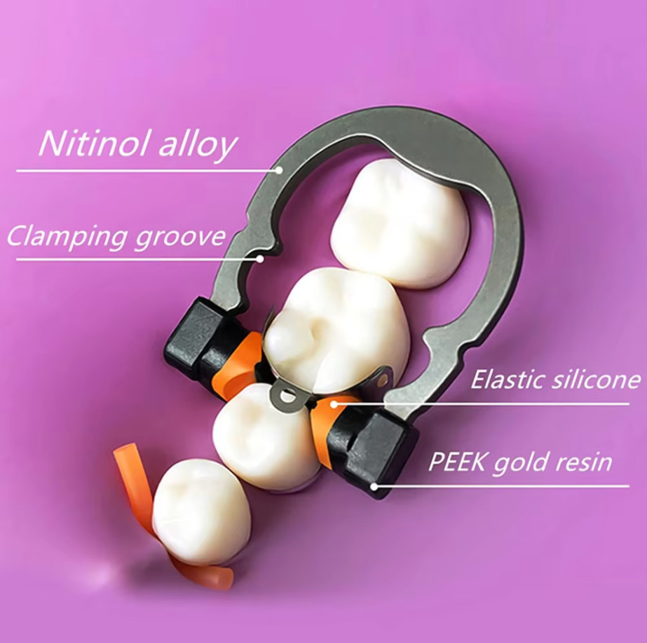 Dental Sectional Matrix System R5 Nickel Titanium Metal Matrices Clip Ring Clamp