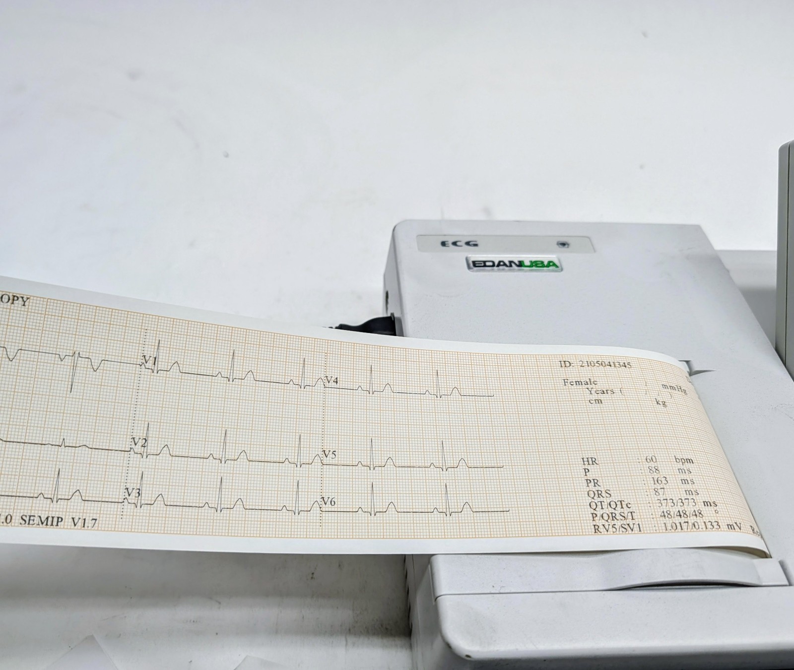 New Edan SE-3 Compact Portable Electrocardiograph ECG/EKG Machine 3Ch 12 Lead