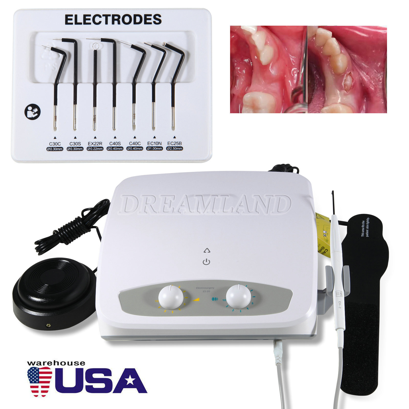Dental High-frequency Electrosurgery Unit ES-20 Electricity Knife 7 Tips US/EU