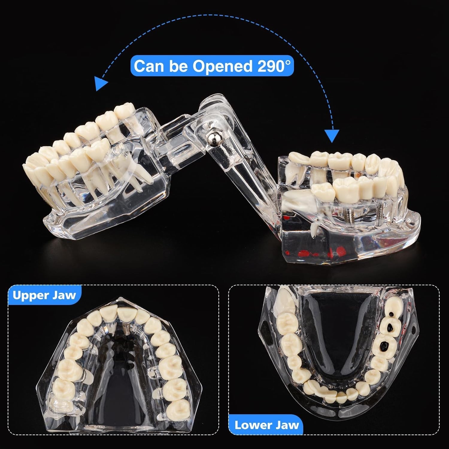 Dental Teaching Tool with Removable Teeth