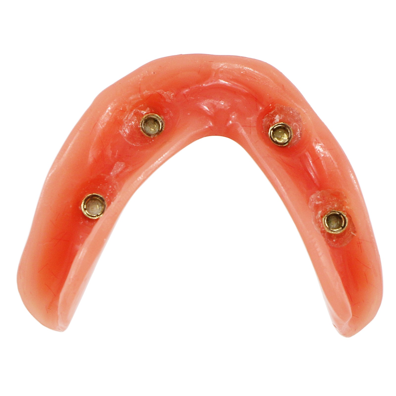 US Dental Implant Teeth Model Overdenture Restoration With4 Implants Upper Lower