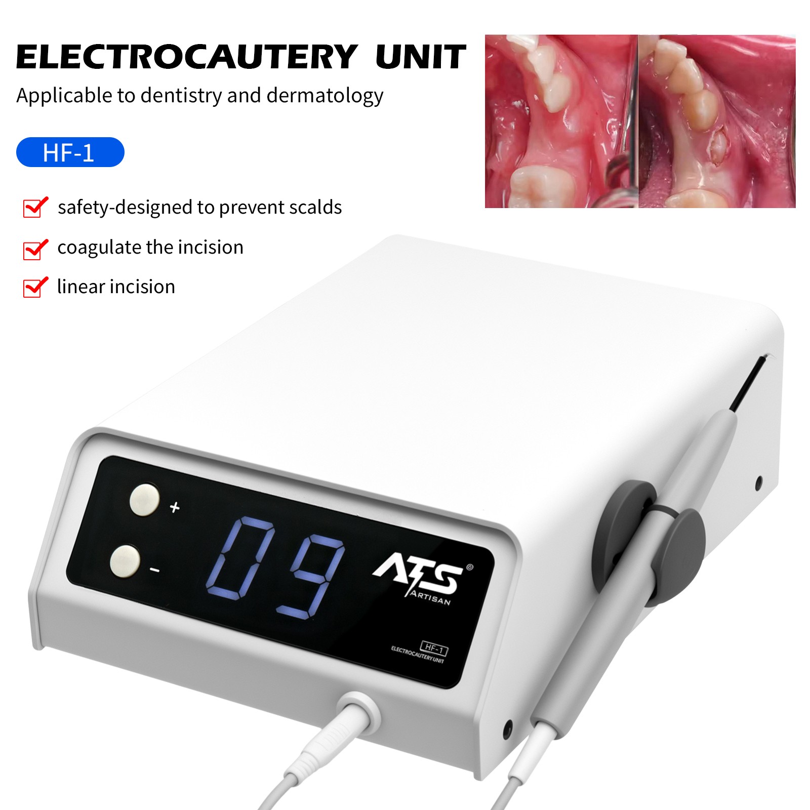 Electrosurgery Unit Dental Electro Dentisty System – High Frequency