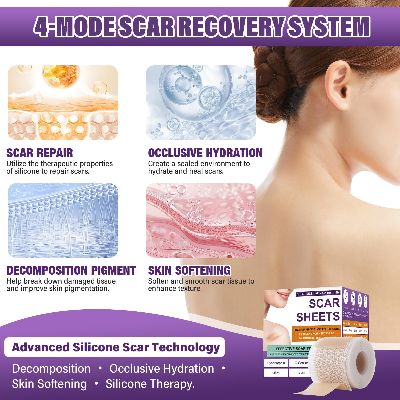 Silicone Scar Sheets, Medical Grade Tape for 1.5M, Beige