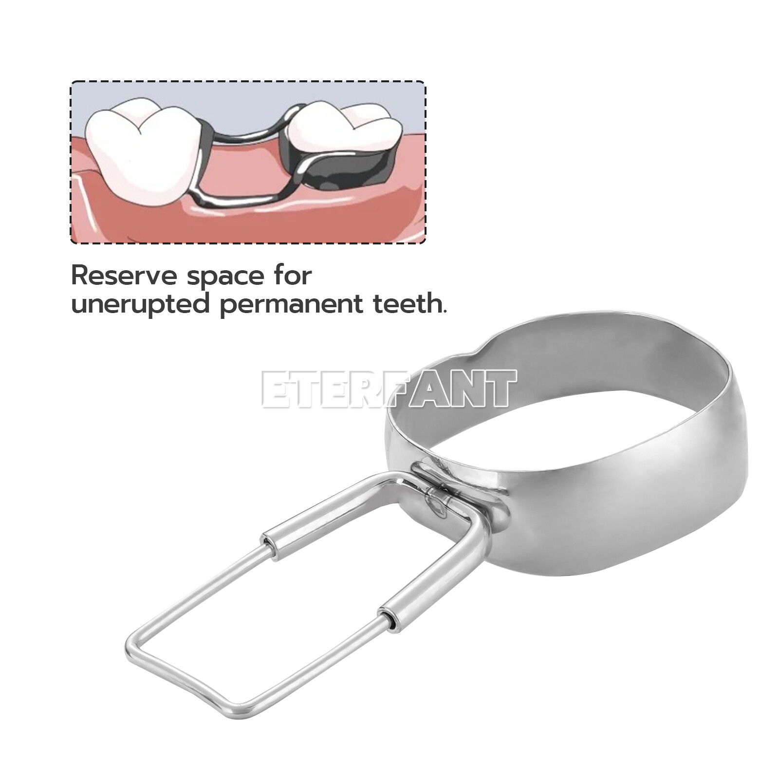 40PCs ETERFANT Dental 2nd Molar Space Maintainer Brace Preformed Band & Loop