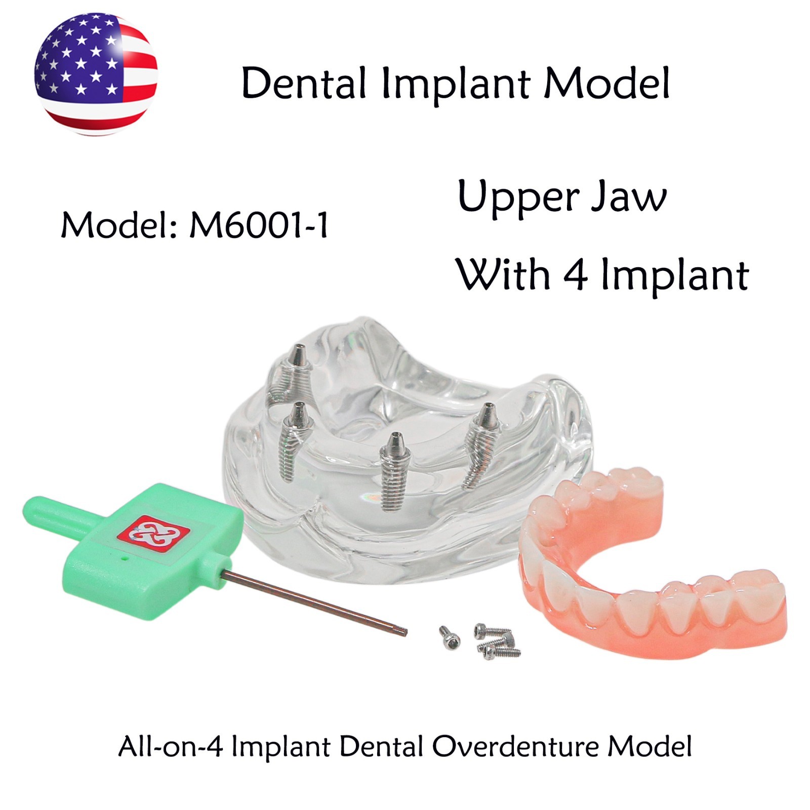 US Dental Implant Overdenture Model All-on-4/6 Upper Jaw Restoration 4/6 Screws