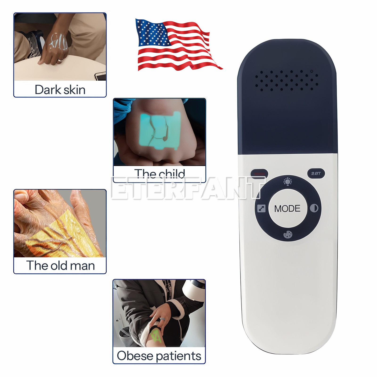 ETERFANT Portable Vein Finder Locator Blood Vessel Device Handheld Vein Detector