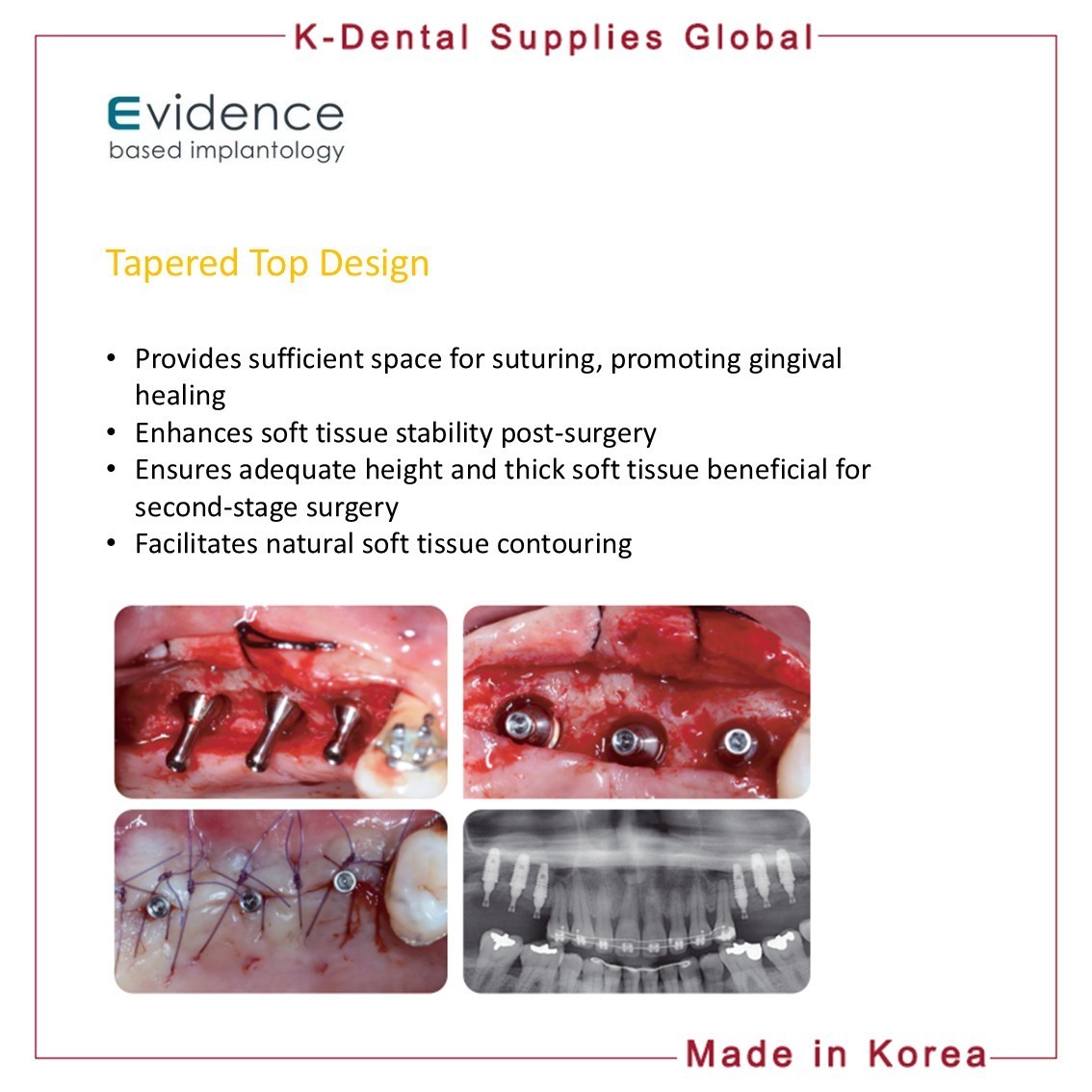 Evidence GBR Healing Pin Abutment