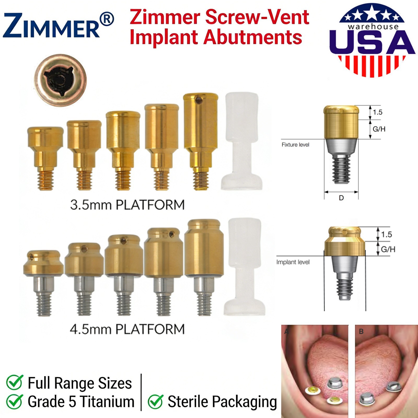 Locator Abutment 1–5mm for Zimmer TSV 3.5/4.5 Compatible MIS Adin Male Caps Tool