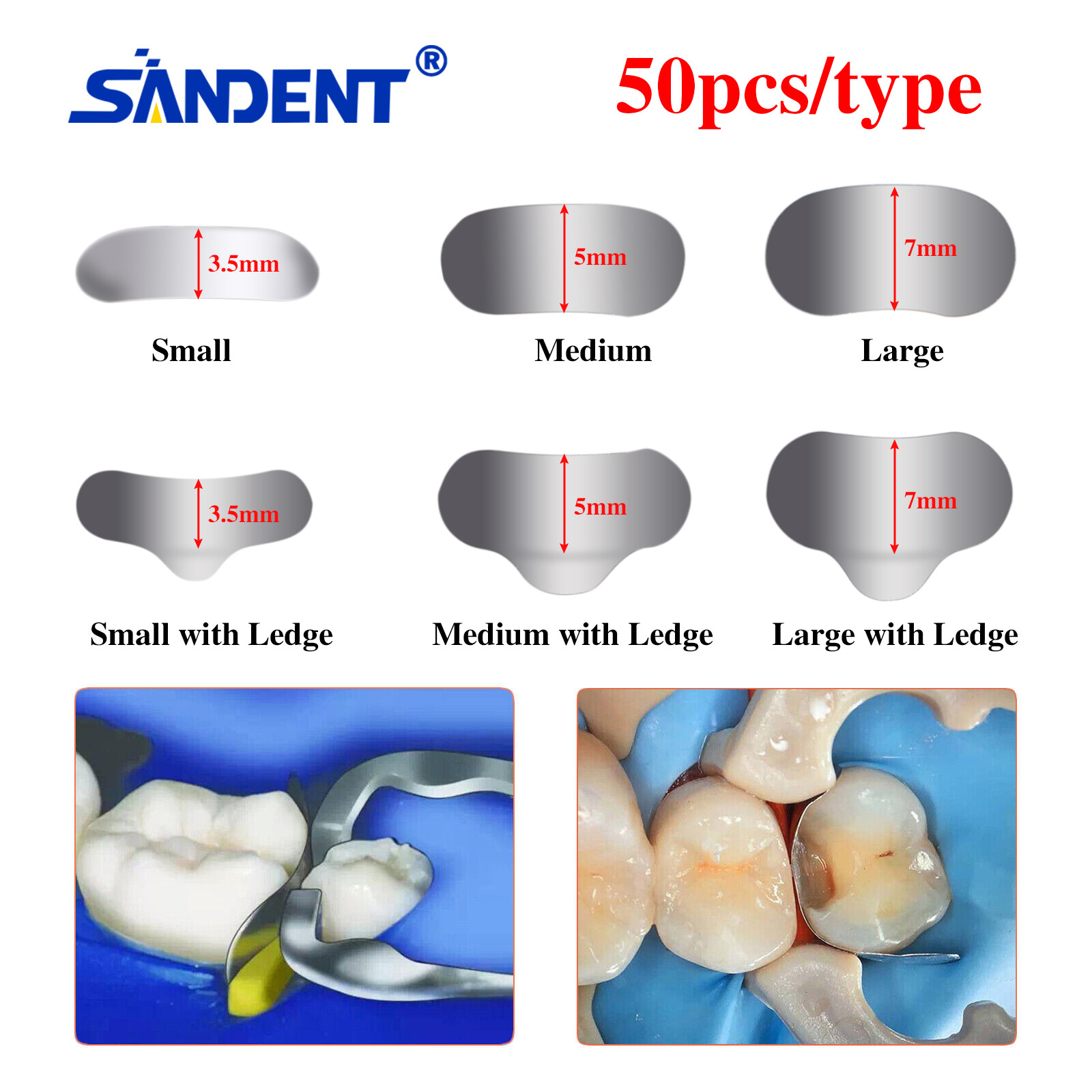 50Pcs Dental Matrices Bands Sectional Contoured Metal Matrix bands hard S/M/L