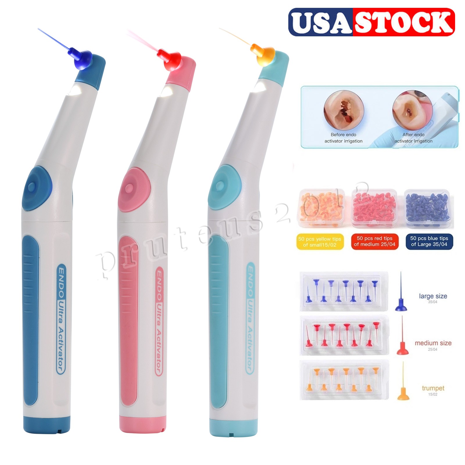 Dental Endodoncia Irrigator Endo Ultra Sonic Activator Root Canal 150 Tips Free