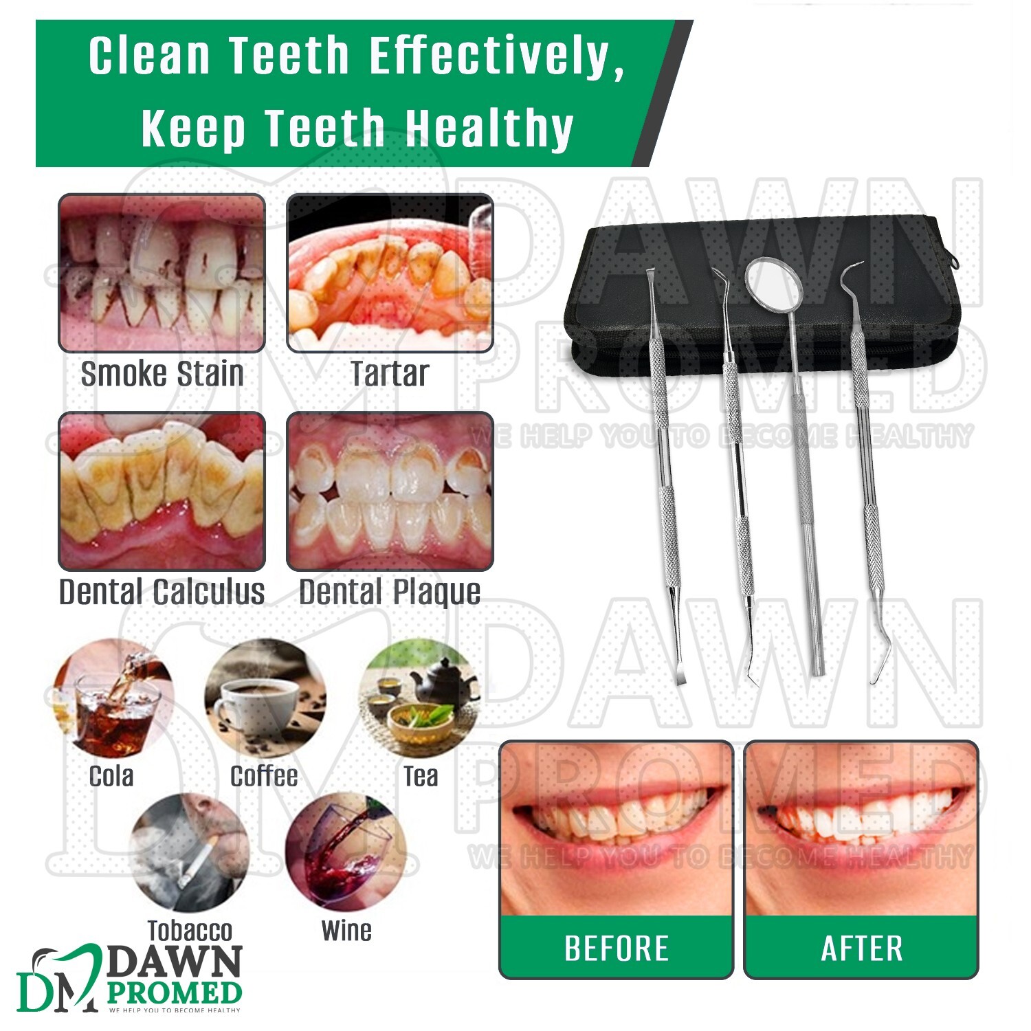 4 Pcs Dental Teeth Cleaning Kit Dentist Scraper Pick Tool Plaque Remover Set