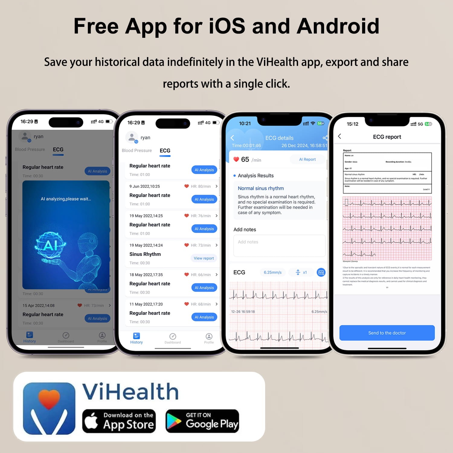 Home EKG Monitor with External Cable, 30s/60s/5min Recording + AI ECG Analysis