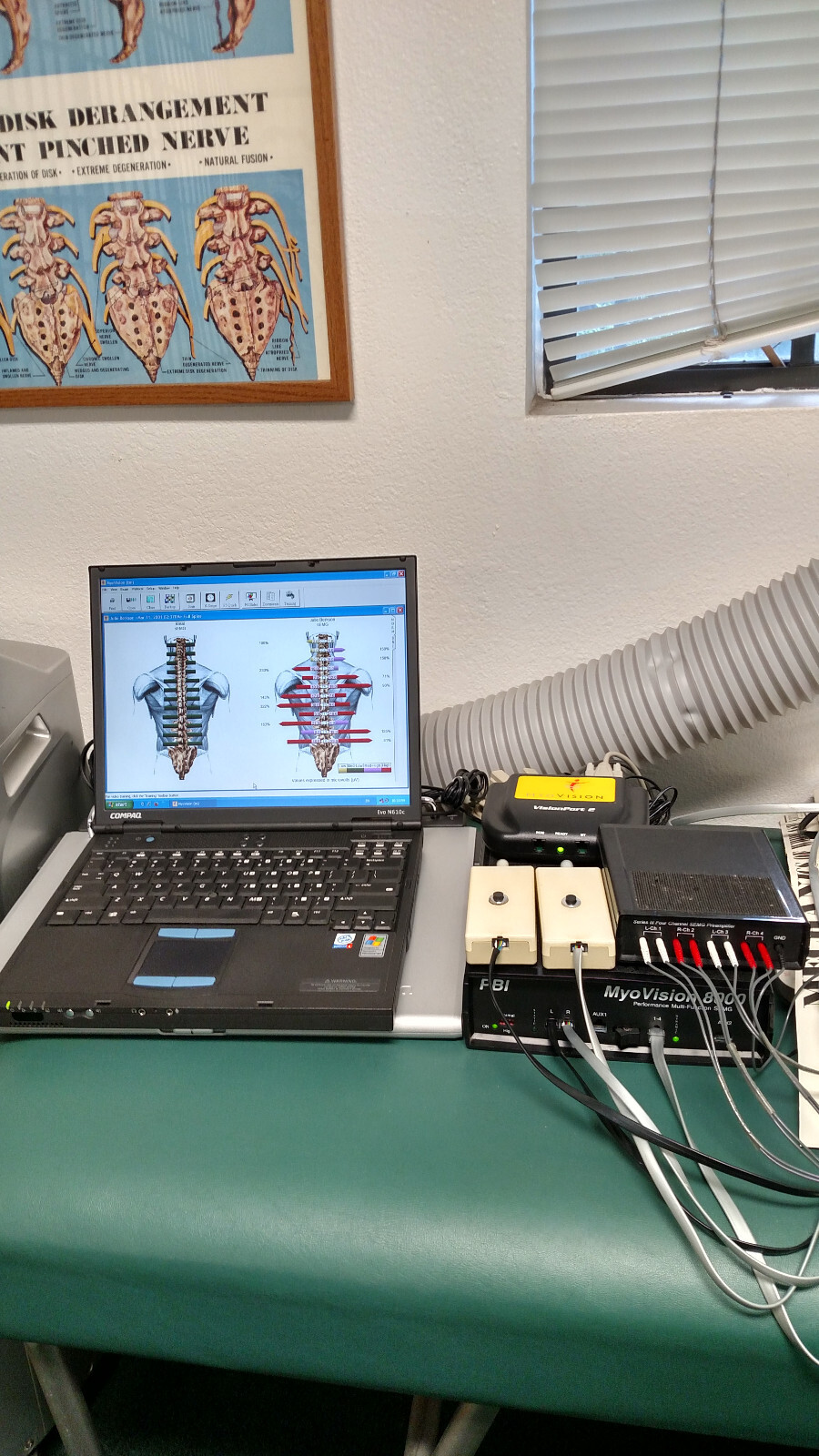 Myovision 8000 Static w/Dynamic sEMG wValidated Laptop Chiropractic Chiropractor