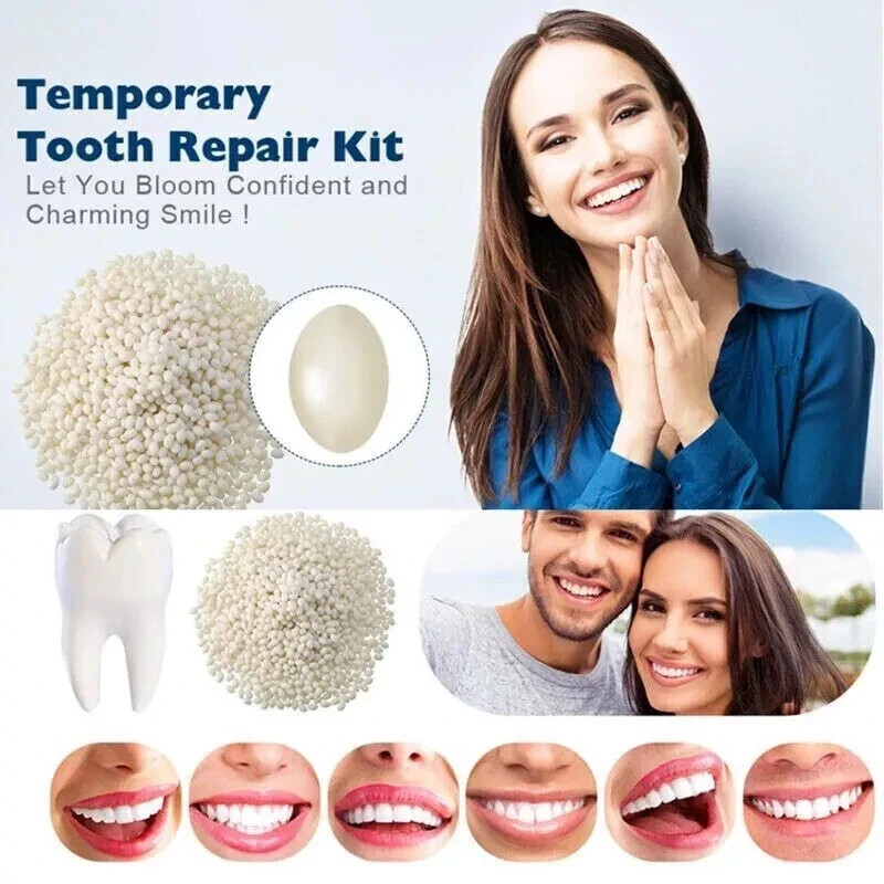Dental Thermal Beads Replacement Temporary 25g ﻿Tooth Denture False Repair Tool