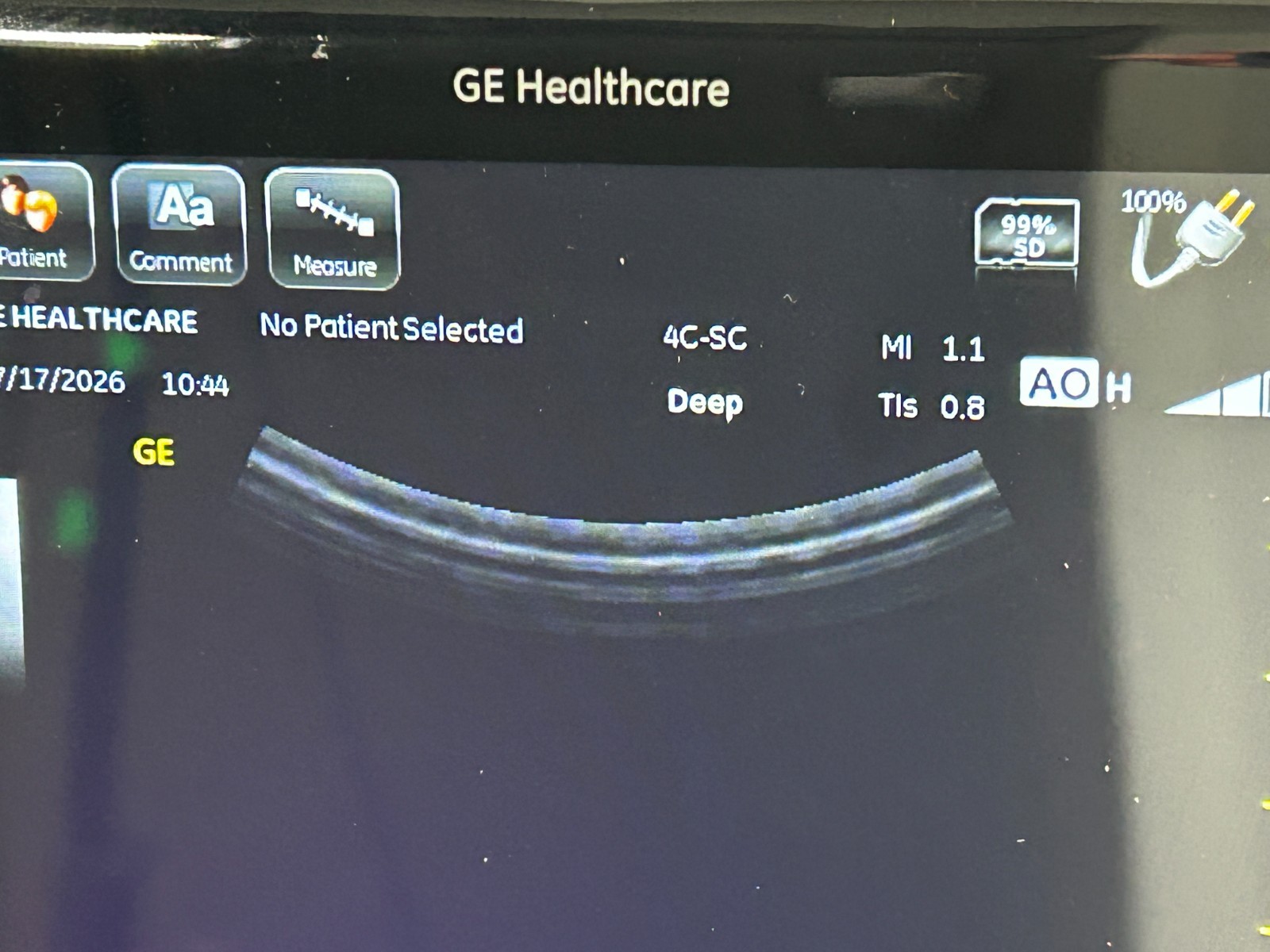 GE Venue 40 Anesthesia Ultrasound with GE 4C-SC Transducer