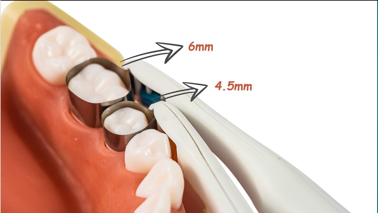 Dental Pro Metal Matrix Bands Molar/Premolar pre formed Bands Restoration Adjust