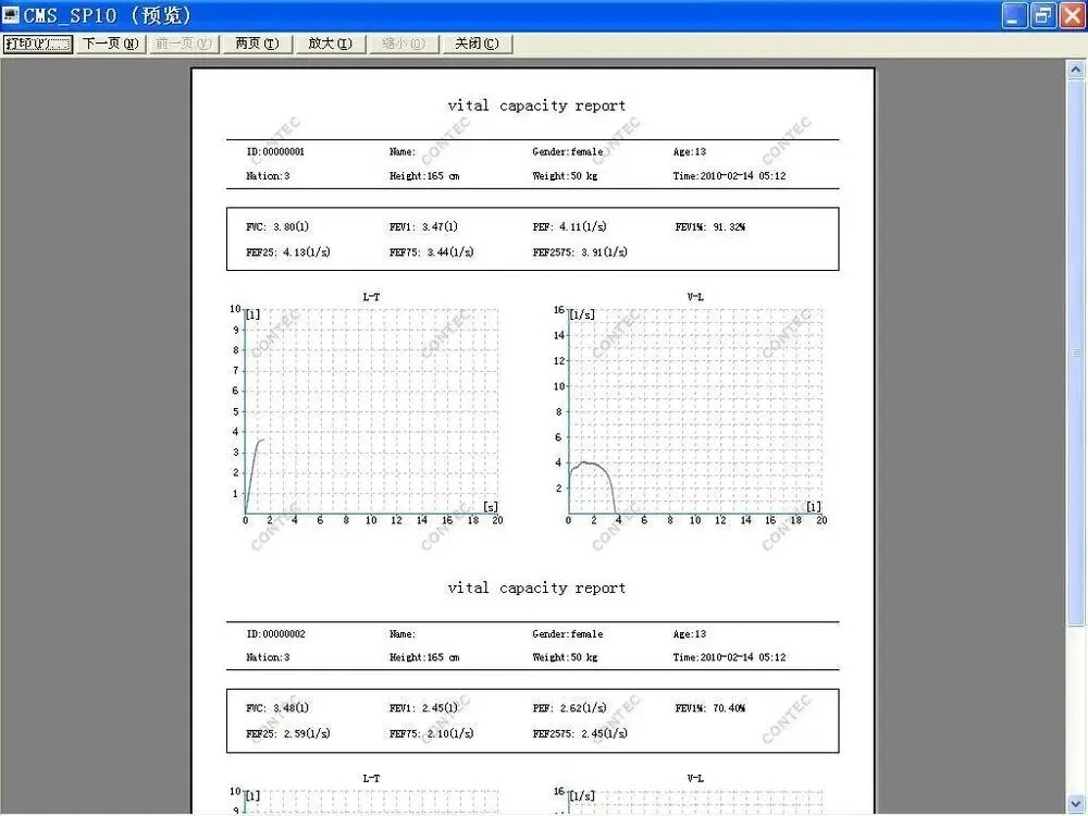 SHIP USA Contec SP10 Digital Electronic Spirometer + Software Clinic or Home Use