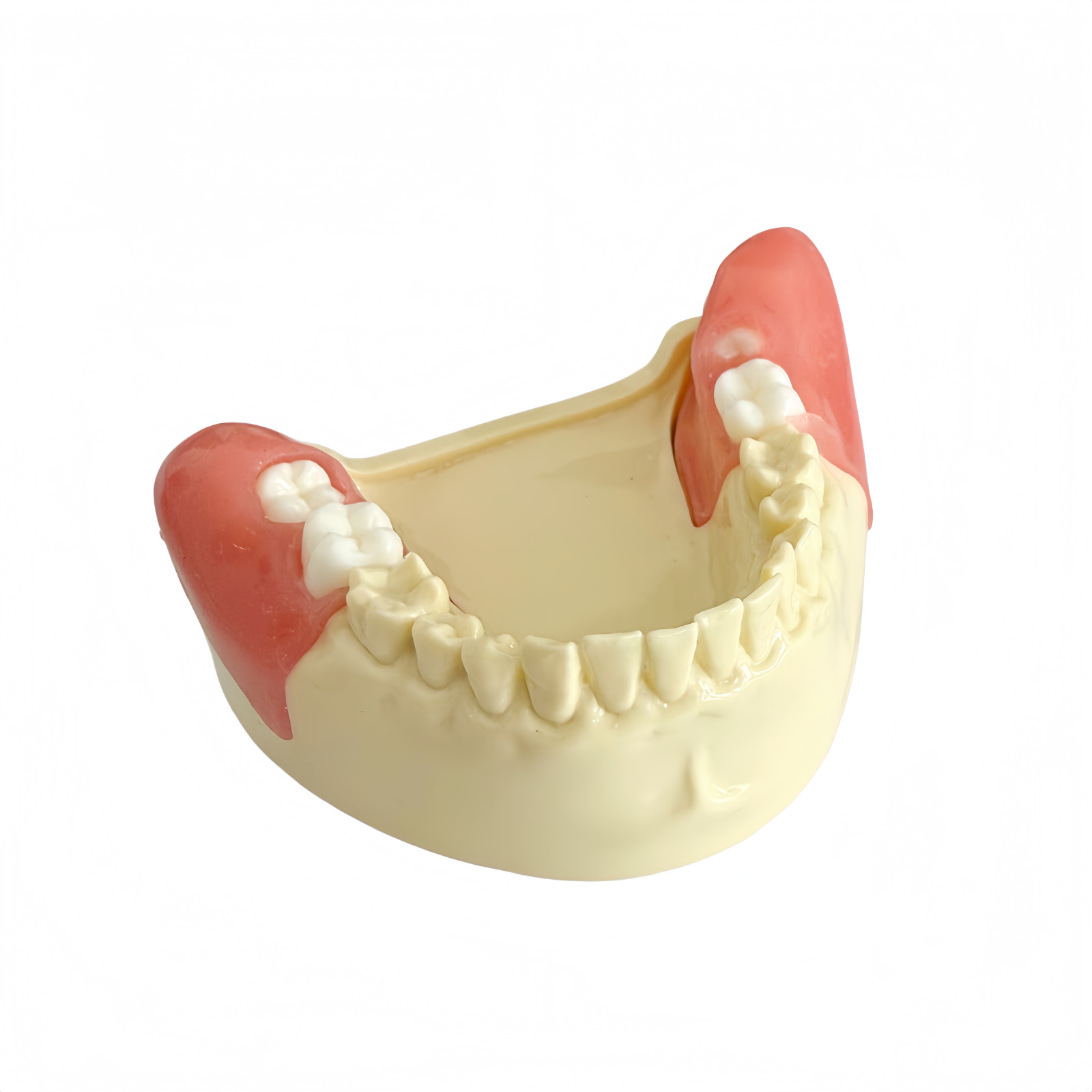 Dental Training Model for Impacted Wisdom Tooth Extraction Practice Surgery