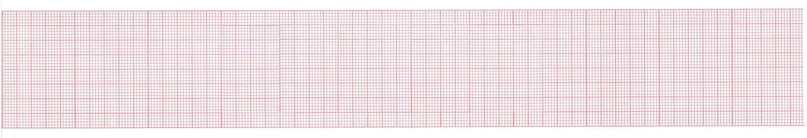 Contec 80A ECG Chart Paper, 50mm X 20m 10 Rolls
