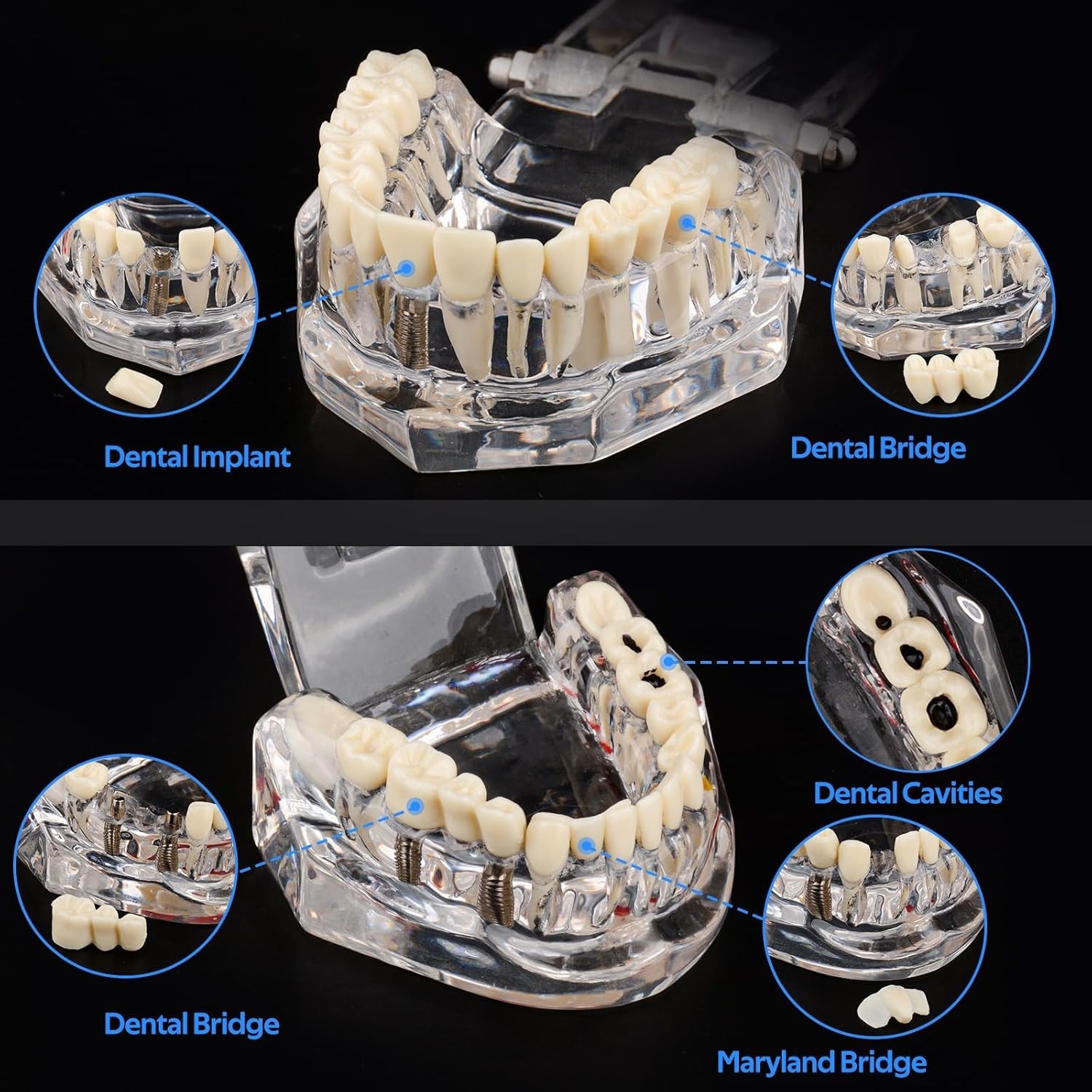Dental Teaching Tool with Removable Teeth